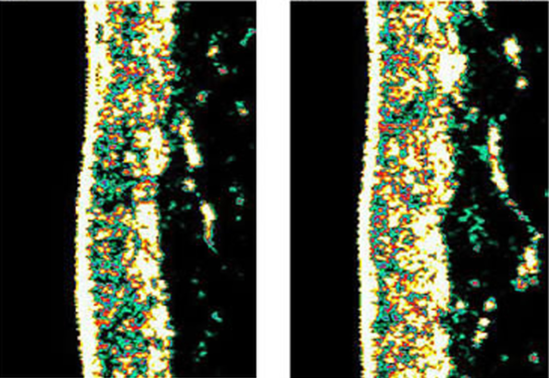 Ecografie cutanee originali del protocollo combinato X115: prima a sinistra, dopo otto settimane a destra