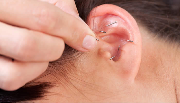 Auricoloterapia per Smettere di Fumare