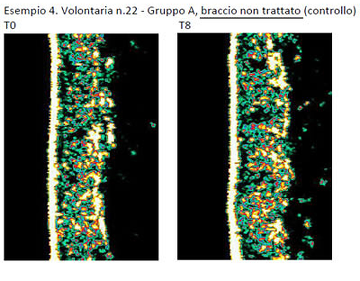 T0 e T8 dell'area di controllo non trattata