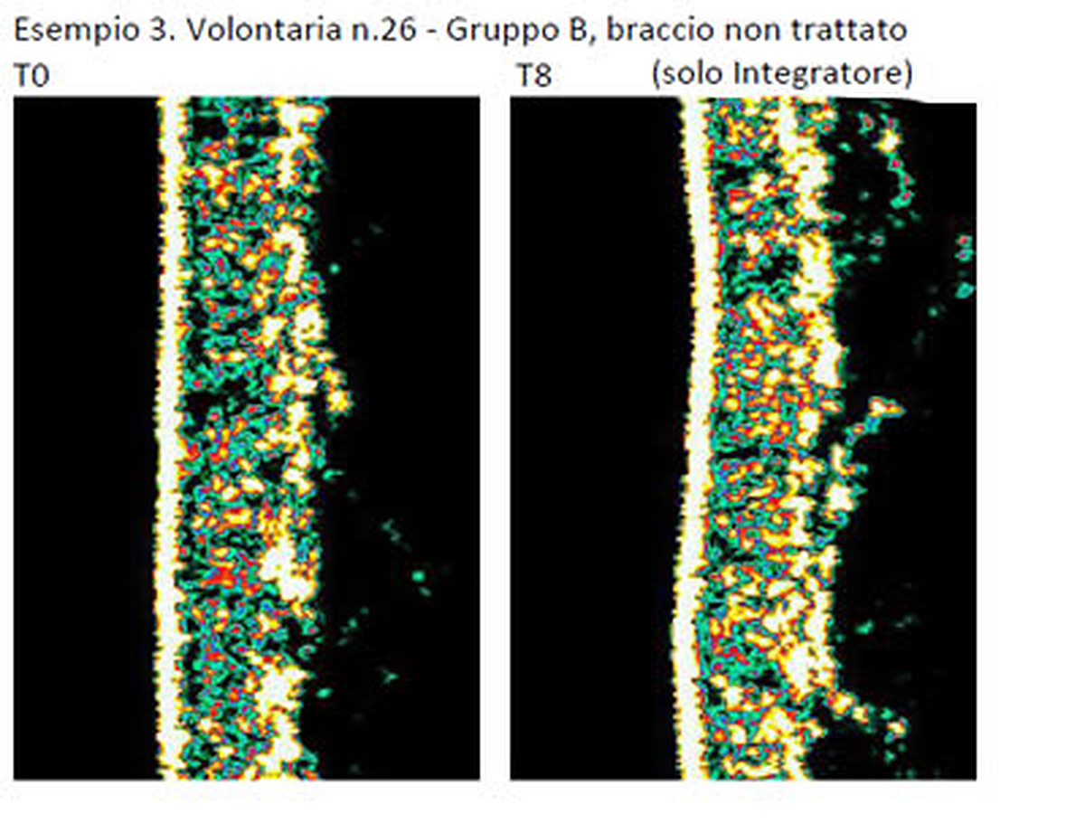 T0 e T8 del gruppo sottoposto al solo integratore