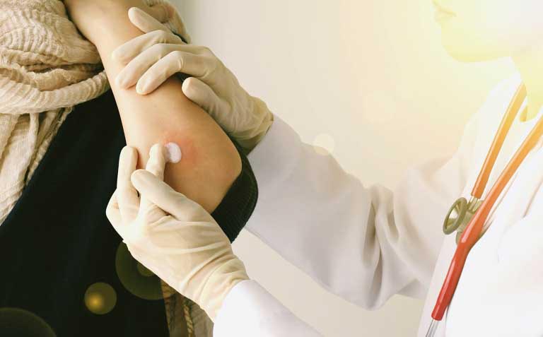 Dermatite Allergica da Contatto | Cura | Farmaci e Cosmetici