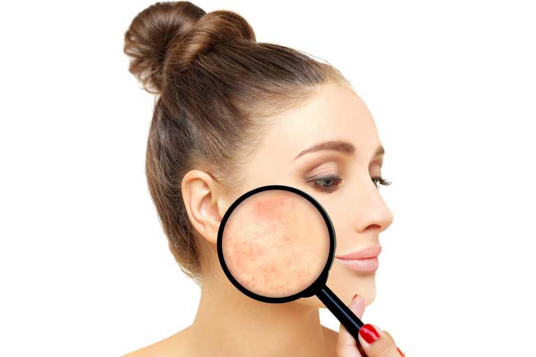 Destrano | Dextran nei Cosmetici | Benefici, Proprietà