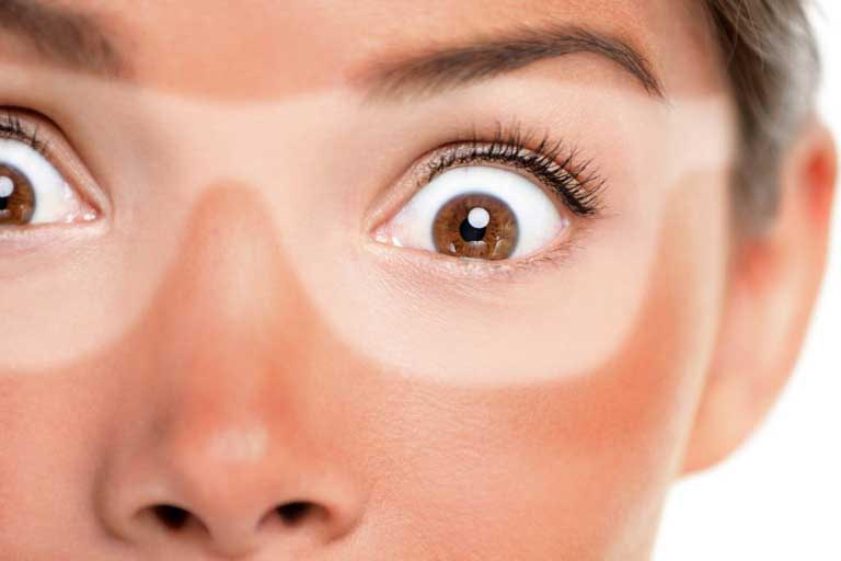Fotodermatosi – Che cos’è? Cause e Rimedi