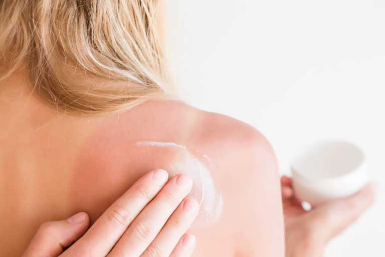 Fotodermatosi: Rimedi e Prevenzione
