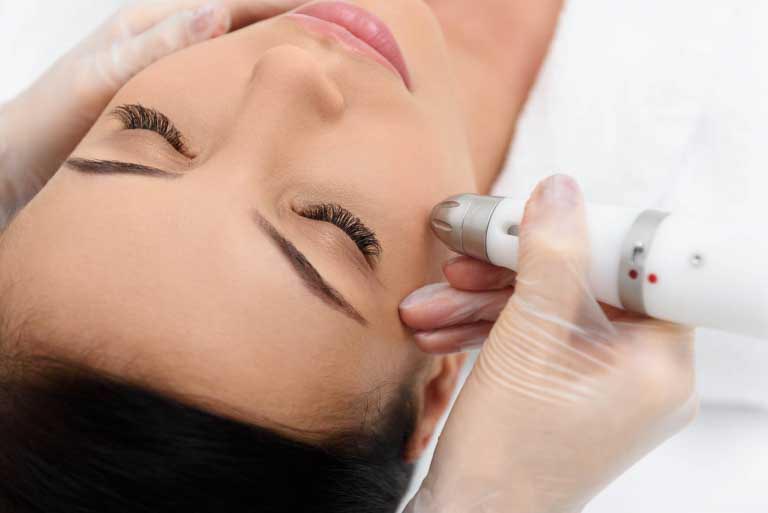 Laser Antirughe | Benefici, Efficacia, Effetti Collaterali