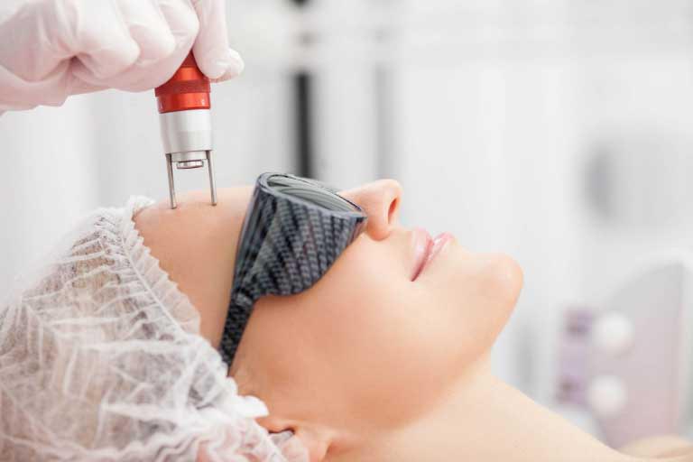 Laser per la Pelle | Tipi | Efficacia, Funzionamento, Rischi