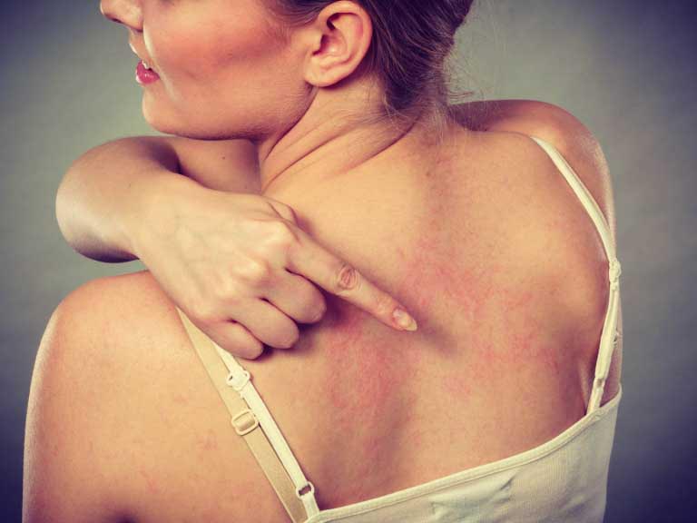 Lesioni Cutanee | Tipi, Classificazione, Caratteristiche