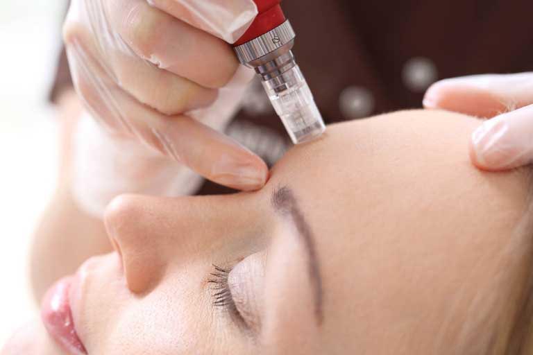 Mesoterapia e Bellezza | Efficacia | Prezzo, Benefici