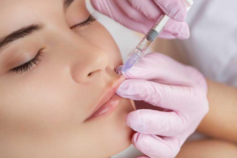 Acido Ialuronico Labbra | Filler | Vantaggi, Prezzo, Rischi