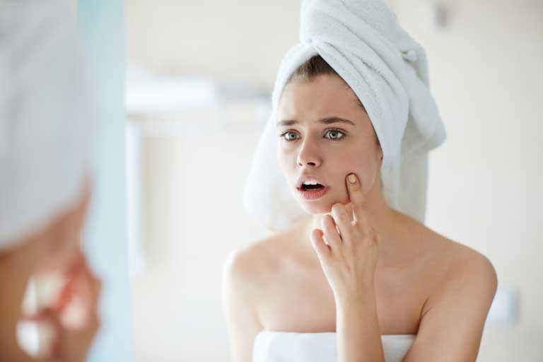 Acido Azelaico | Contro Acne, Macchie della Pelle, Alopecia