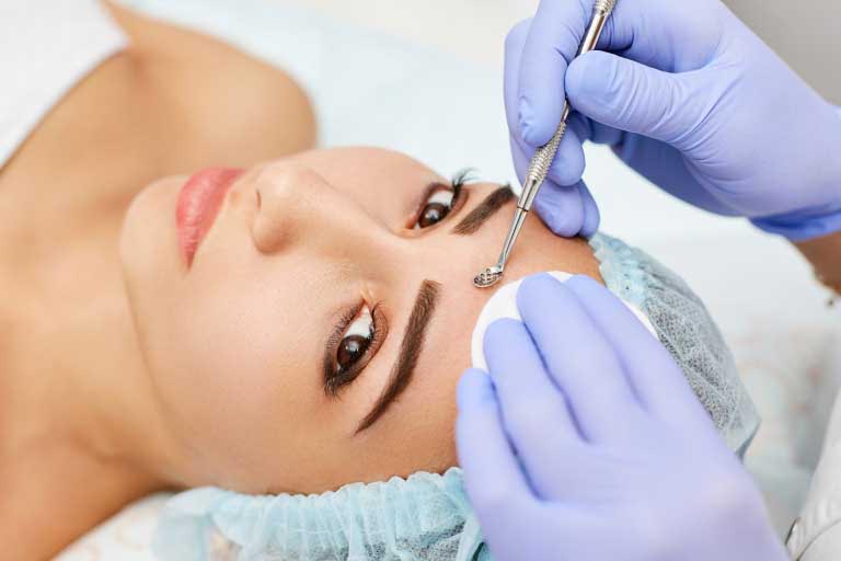 Acido Tricloroacetico | Peeling | Usi, Benefici, Rischi