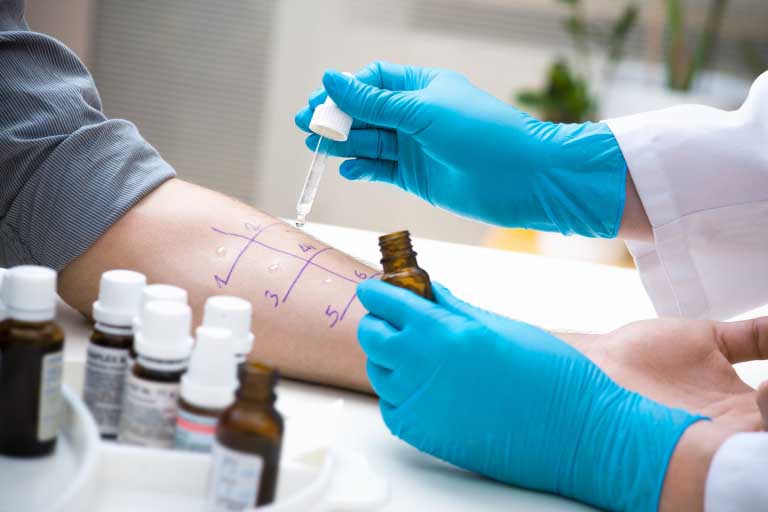 Methylchloroisothiazolinone | Allergie e Uso nei Cosmetici