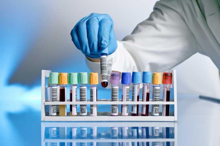Sistema Immunitario Debole | Analisi del Sangue, Esami