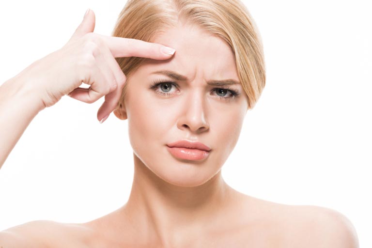 Rughe di Espressione | Cause, Tipi | Soluzioni Efficaci
