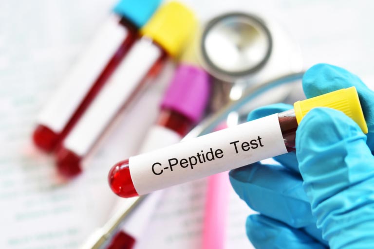 Peptide C Basso | Perché? Cause e Come Aumentarlo