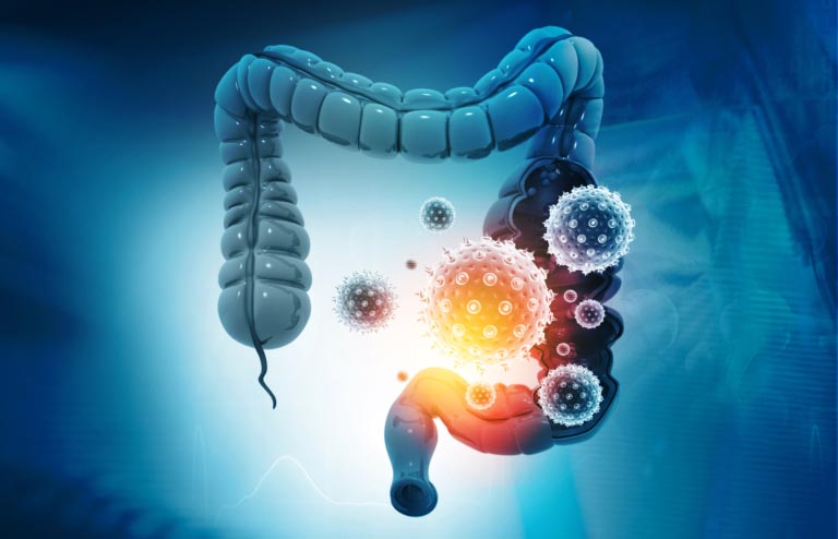 Acido Butirrico | A Cosa Serve | Dosi e Benefici per Intestino