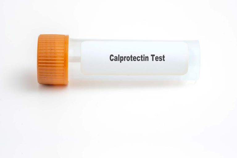 Calprotectina Alta | Cause, Valori Normali | Trattamento