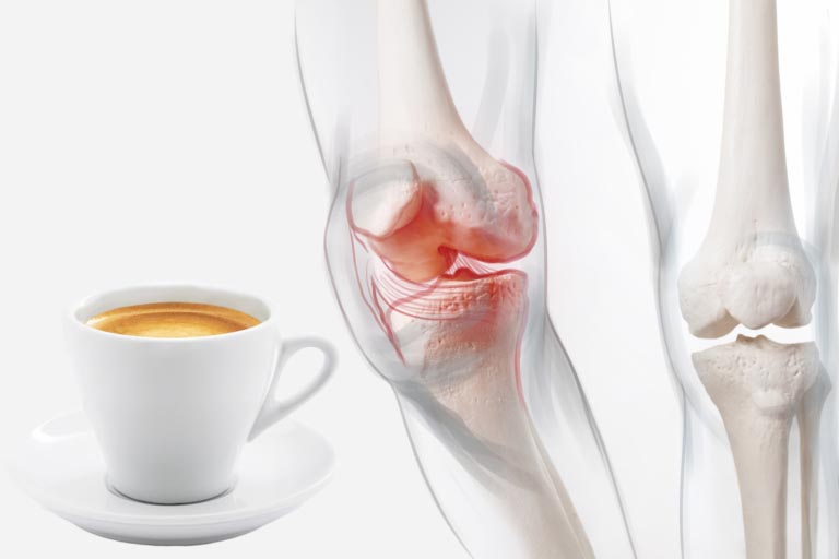 Caffè, Artrosi e Artrite Reumatoide | Fa Male o Fa Bene?