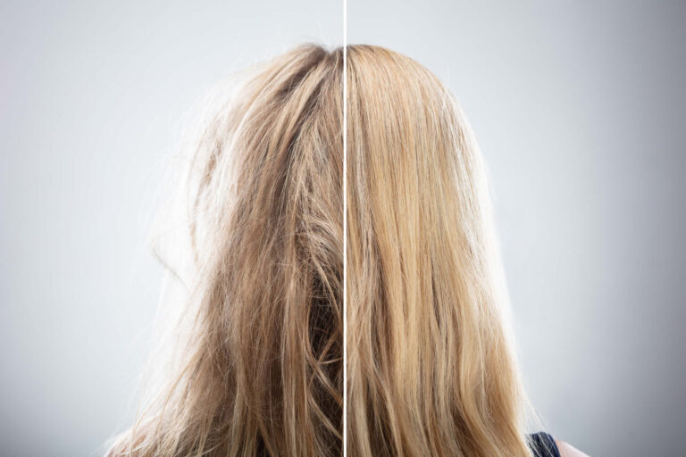 Integratori di Cheratina | Benefici per Pelle e Capelli | Dosi, Consigli