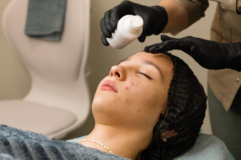 BHA | Beta Idrossiacidi | Usi Cosmetici | Benefici, Controindicazioni