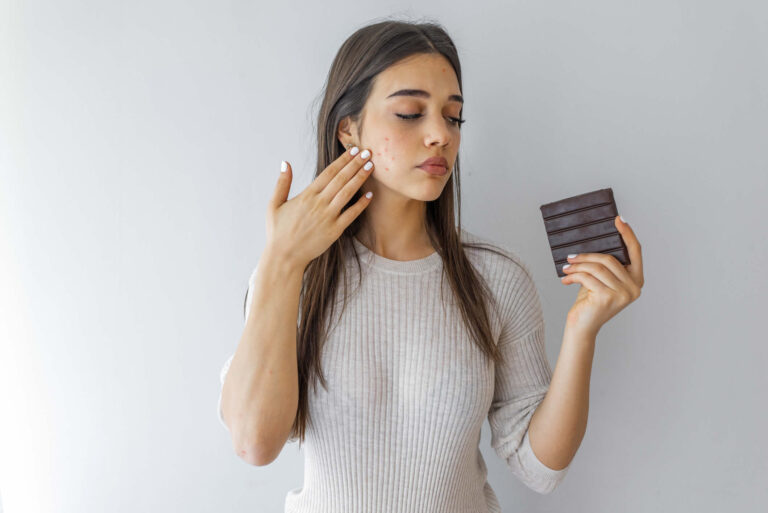 Acne | Integratori e Cibi Utili | Cosa Mangiare, Cosa Evitare