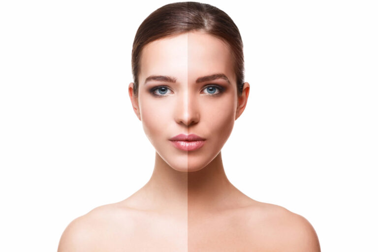 Sintesi di Melanina | Come Aumentarla Naturalmente