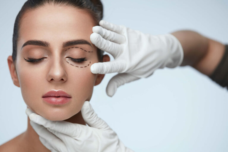 Blefaroplastica Laser | Come si Esegue? Vantaggi, Benefici, Rischi