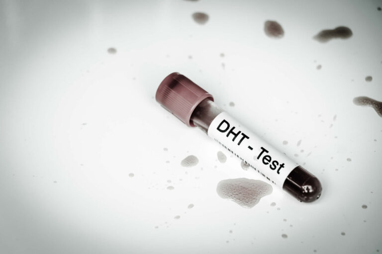 DHT | Diidrotestosterone | Funzioni, Valori Normali, Salute