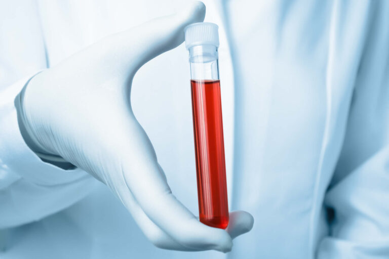 Eritropoietina | EPO | Funzioni, Doping | Come Aumentarla