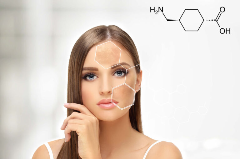 Acido Tranexamico | Melasma, Benefici per la Pelle | Come si Usa