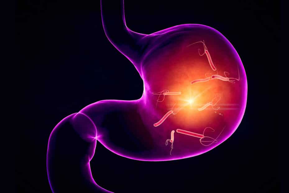 Helicobacter Pylori | Esistono Alimenti e Integratori Utili ed Efficaci?