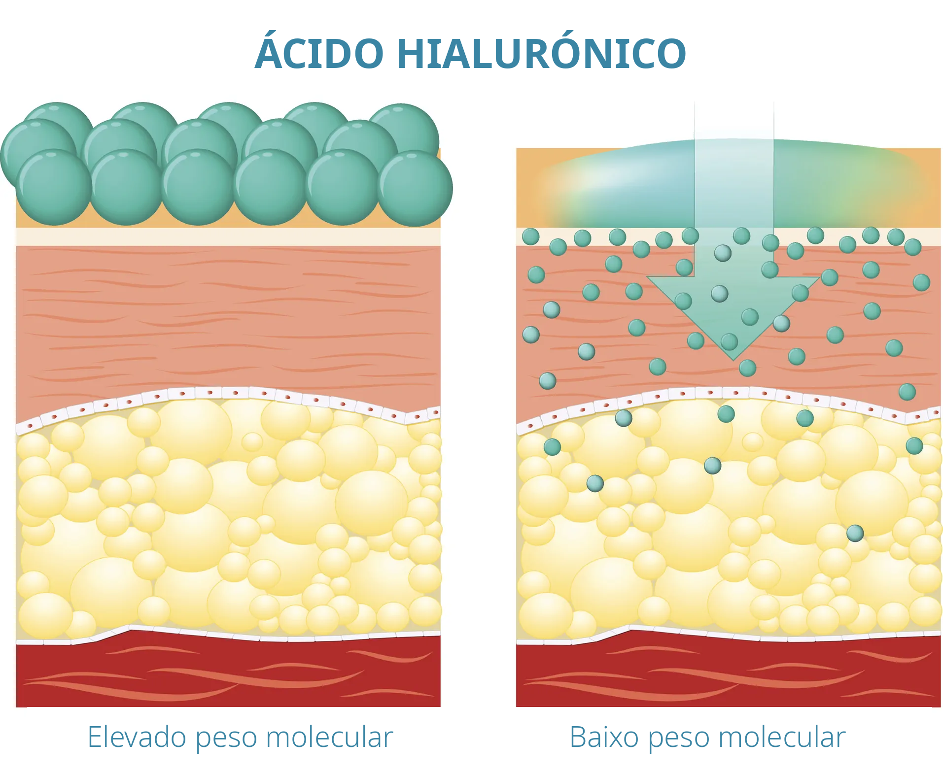 Cremes com Ácido Hialurónico | Benefícios, Eficácia e Limites