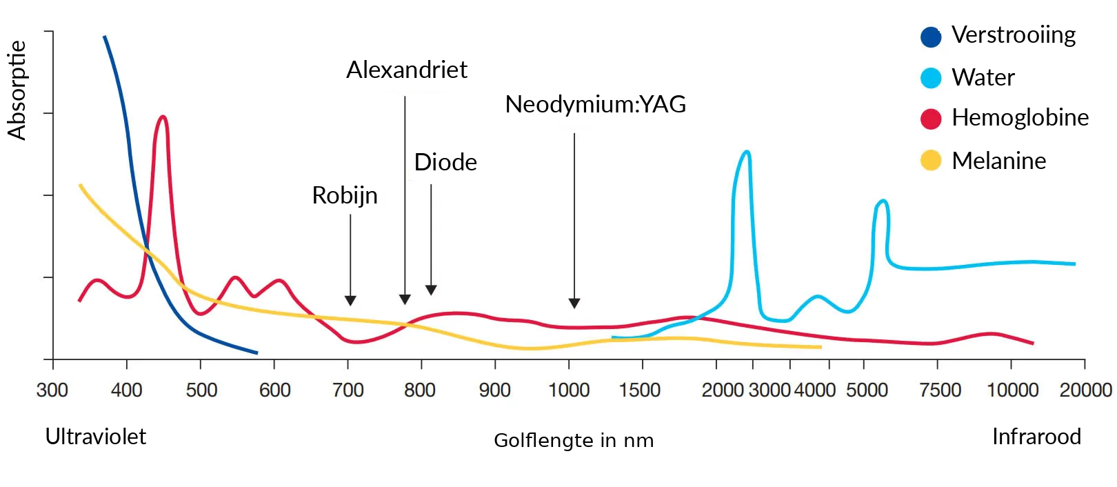 Behandeling met de alexandrietlaser