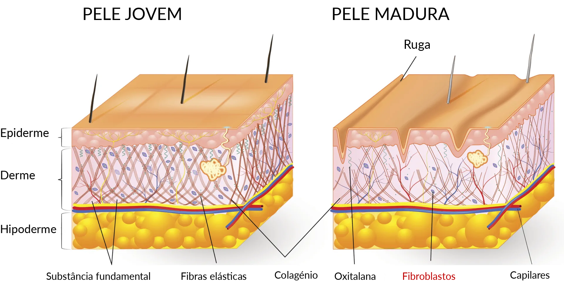 Fibroblastos dérmicos da pele