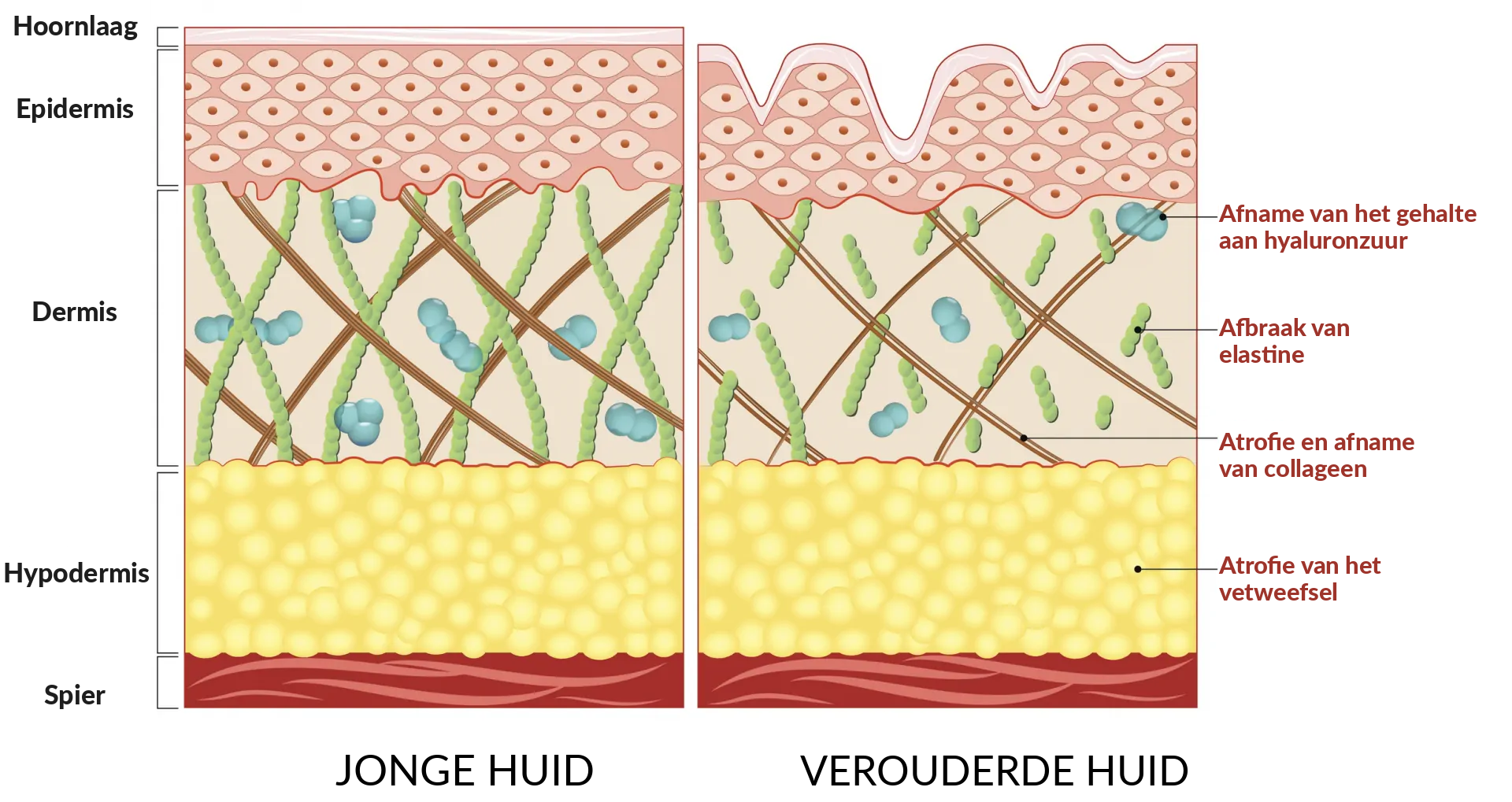 Huidveroudering – elastine en collageen