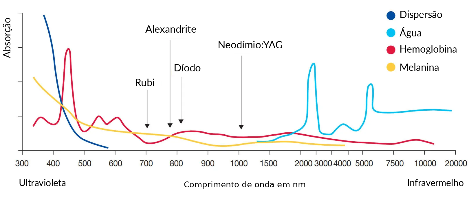 Tratamento com laser de alexandrite