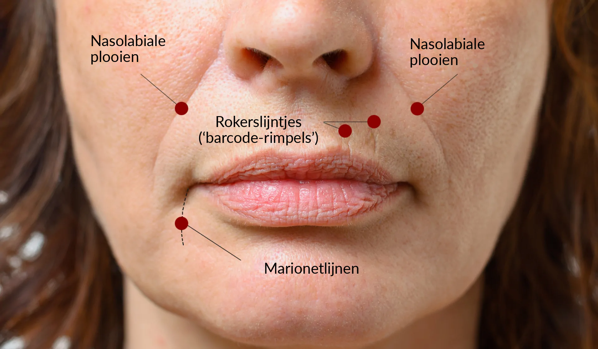 Lippen