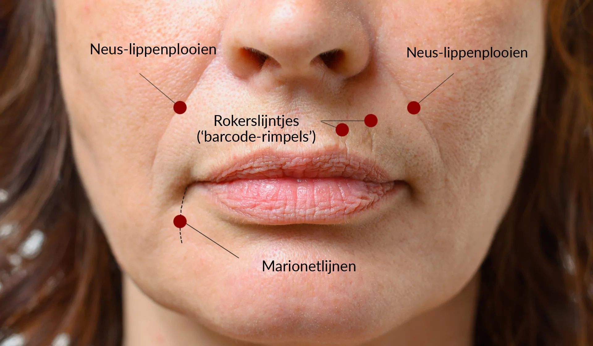 Rimpels rond de lippen