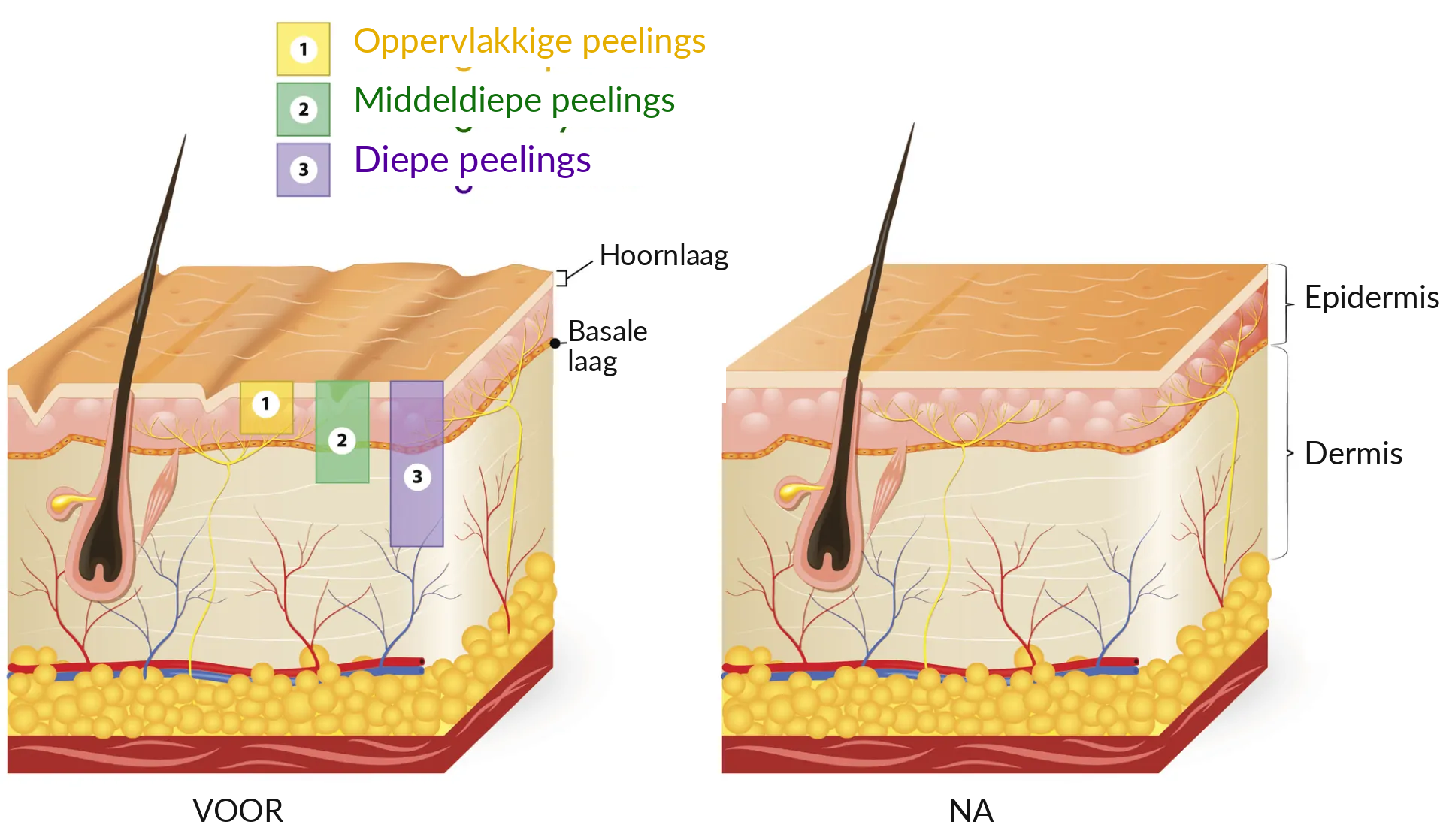 Diepte van peelings