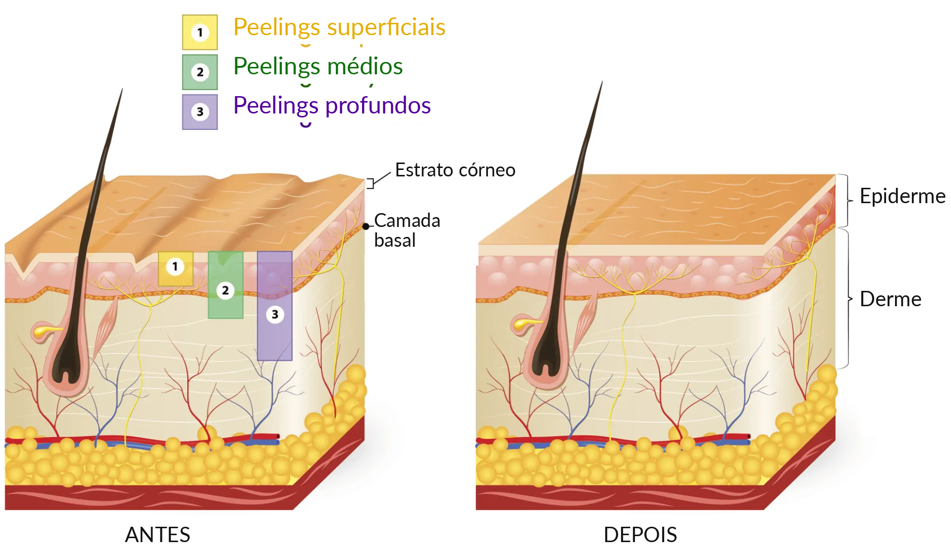 Profundidade dos peelings