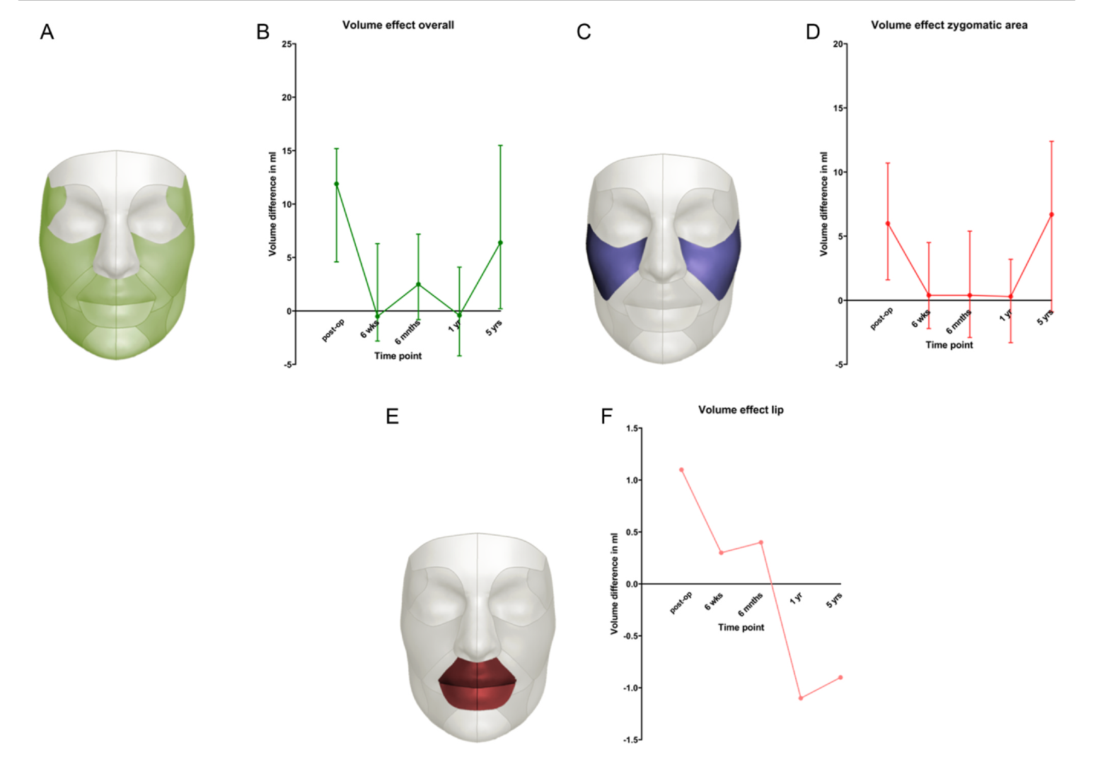 Figura originale dello studio Schipper: aree facciali misurate e variazione del volume visibile nel tempo.